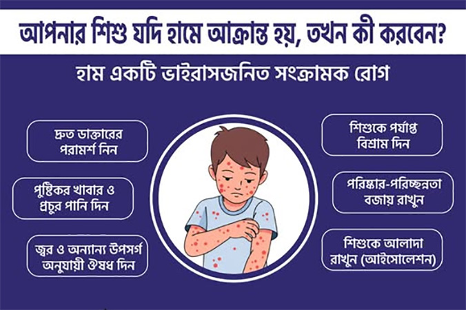 বাংলাদেশে হামে শিশু মৃত্যু ৫০০ ছাড়াল: বিশ্বে শীর্ষে, করোনা মহামারির চেয়েও ভয়াবহ
